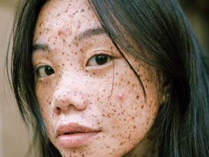 Comprendre les 4 types de peau.
